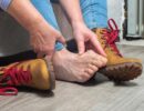 Индивидуальные стельки или упражнения – что эффективнее при ‘шишке’ на большом пальце стопы? Как избавиться от косточки на стопе?