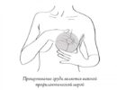 Почему изменяется размер и форма груди? Гормоны! Почему растет грудь у женщин и мужчин?