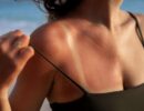 Правила ухода за кожей после солнечных ванн — вы забываете об этом