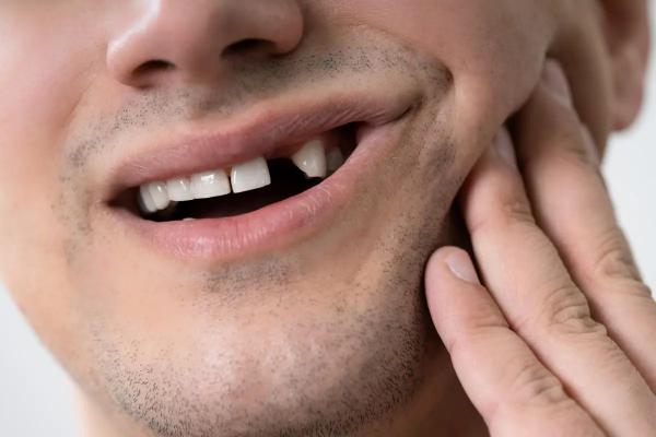 Что происходит с организмом, если потерять зубы безвозвратно. Чем грозит потеря зубов